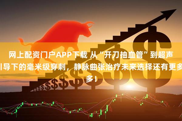 网上配资门户APP下载 从“开刀抽血管”到超声引导下的毫米级穿刺，静脉曲张治疗未来选择还有更多！